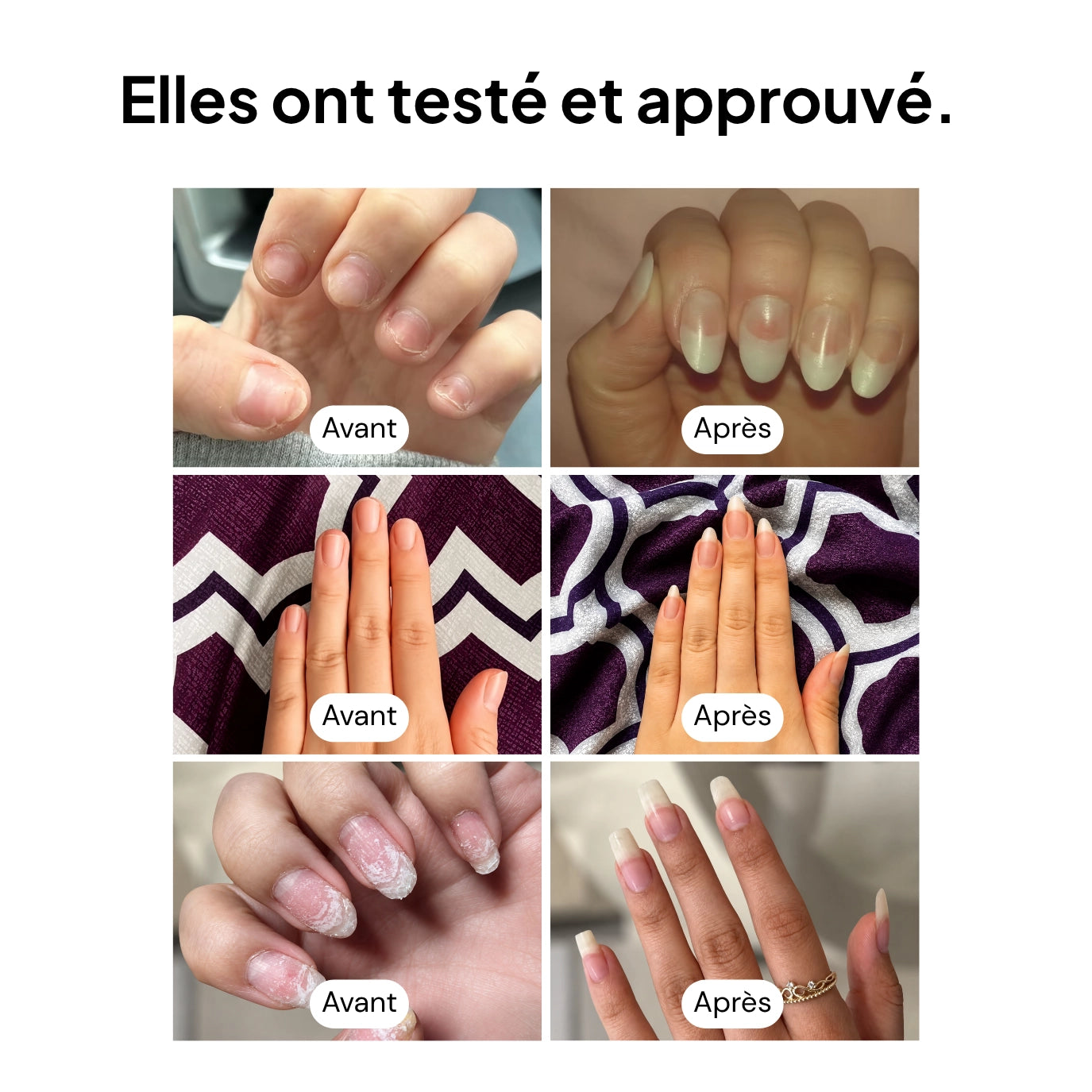 Sérum Croissance & Renforcement des ongles