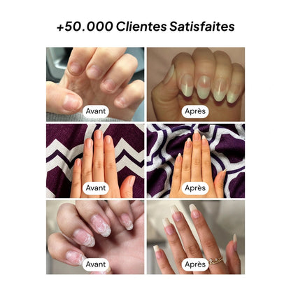 Sérum Croissance & Renforcement des ongles - NAILYPOP