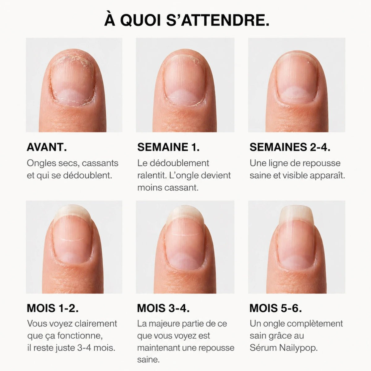 Sérum Croissance & Renforcement des ongles - NAILYPOP