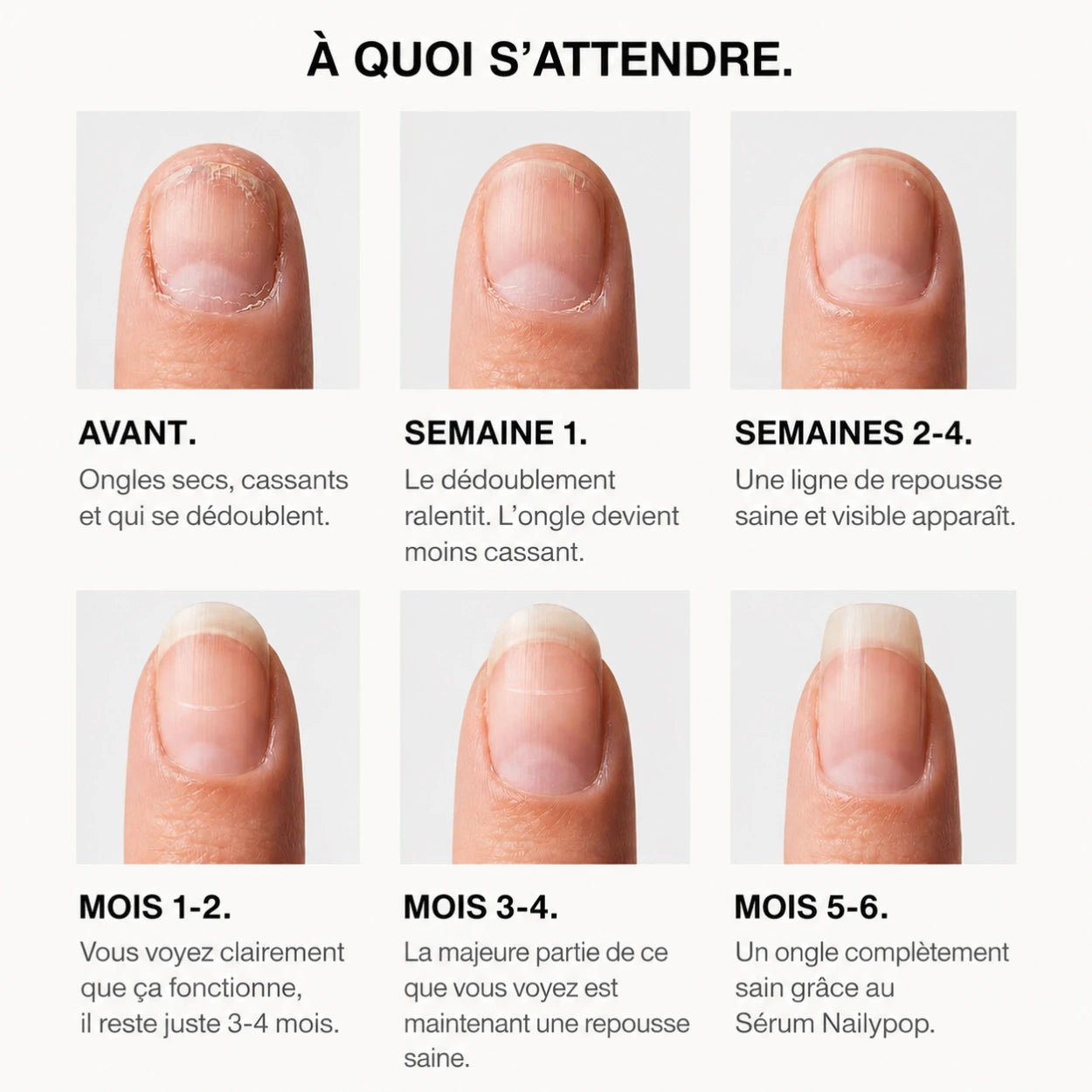 Sérum Croissance & Renforcement des ongles - NAILYPOP