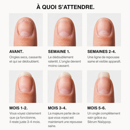 Sérum Croissance & Renforcement des ongles - NAILYPOP