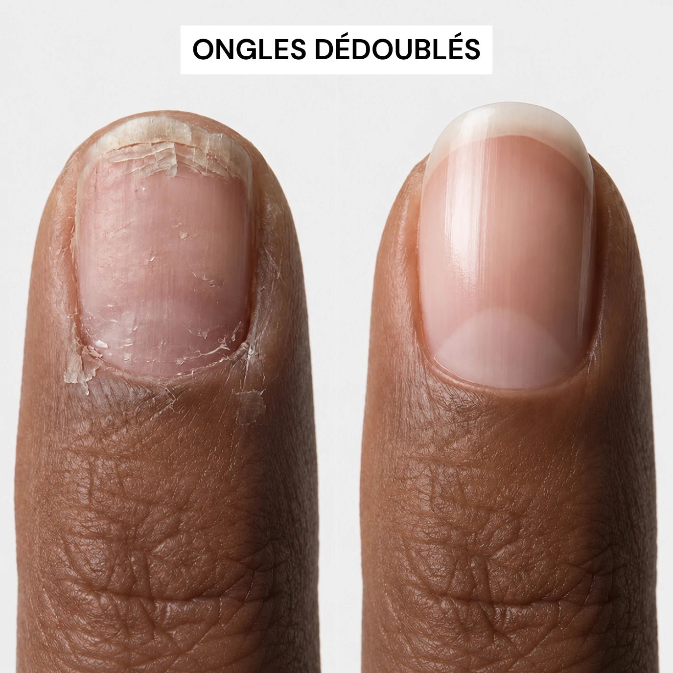 Sérum Croissance & Renforcement des ongles - NAILYPOP