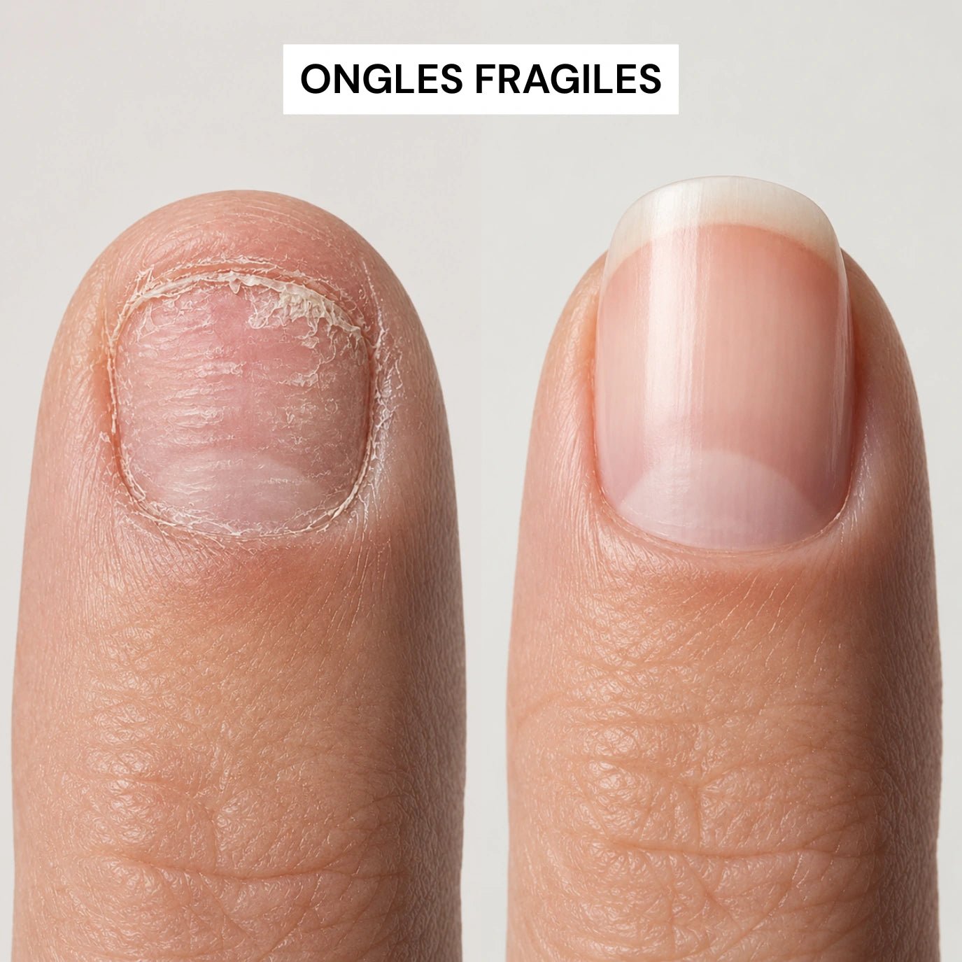 Sérum Croissance & Renforcement des ongles - NAILYPOP